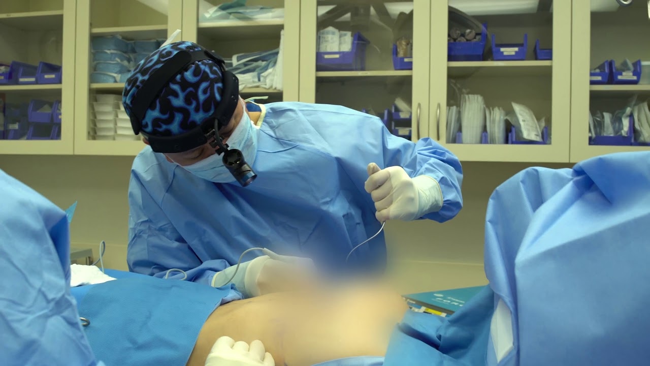 Bruststraffung: Techniken und Trends der modernen Chirurgie